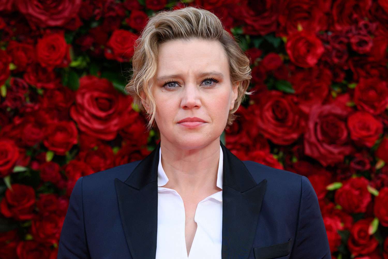 Kate McKinnon reveals she was identified with geographic tongue