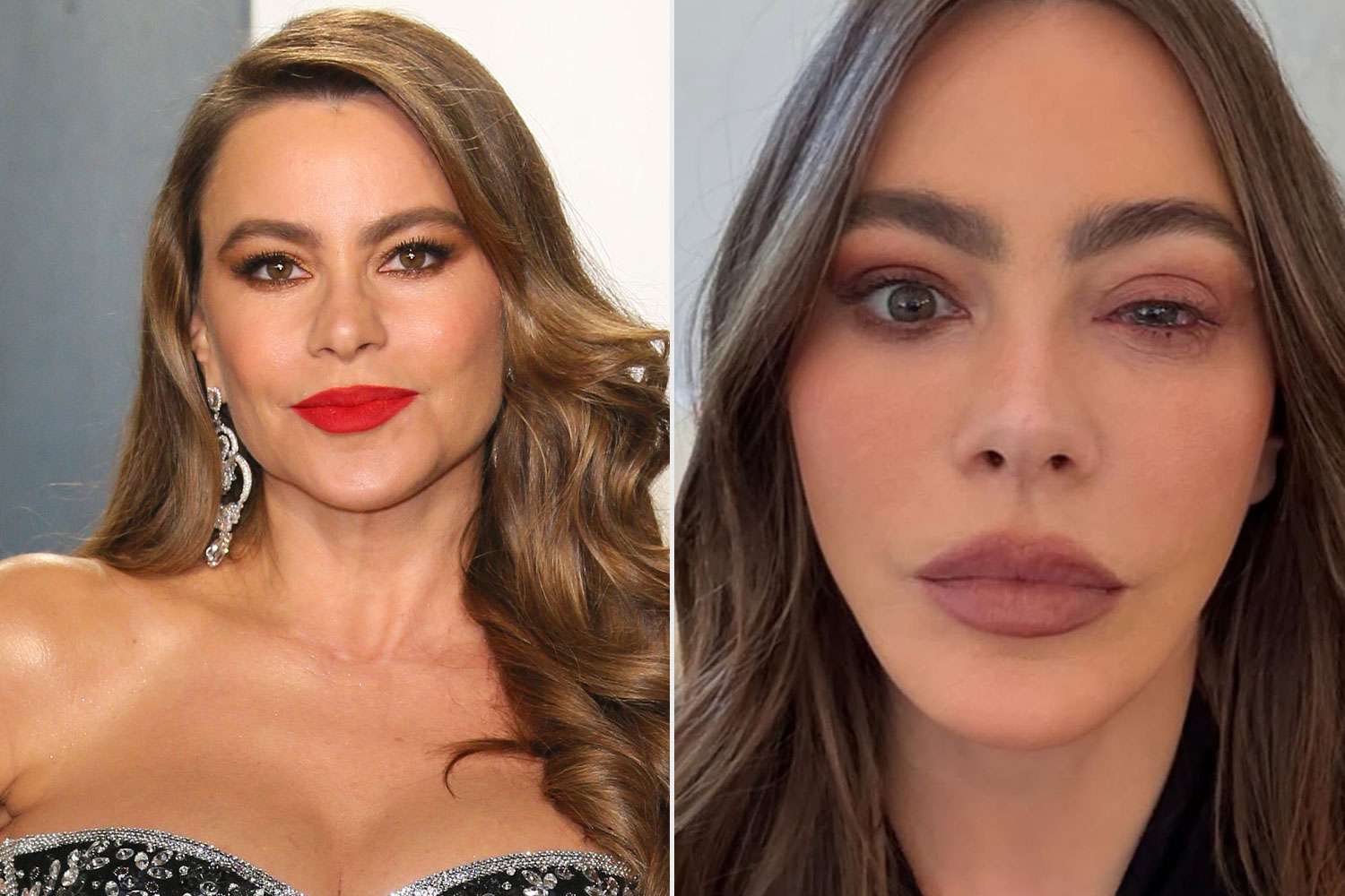 Sofía Vergara skips Emmys presenter responsibility attributable to allergic response: ‘Made it to the ER’